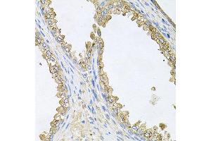 Immunohistochemistry of paraffin-embedded human prostate using HSP90AA1 antibody at dilution of 1:100 (x40 lens).