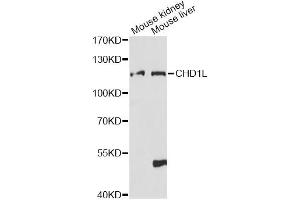Western blot analysis of extracts of various cell lines, using CHD1L antibody (ABIN6291909) at 1:1000 dilution. (CHD1L anticorps)