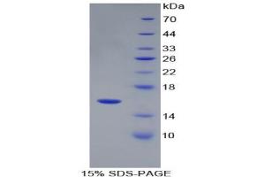 SDS-PAGE of Protein Standard from the Kit (Highly purified E.