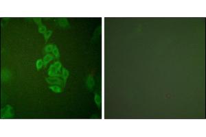 Immunofluorescence analysis of A549 cells, using NSE antibody. (ENO2/NSE anticorps)