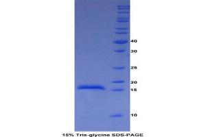 SDS-PAGE analysis of Cow ADAMTS2 Protein.