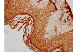 IHC image of ABIN7144524 diluted at 1:600 and staining in paraffin-embedded human skin tissue performed on a Leica BondTM system.