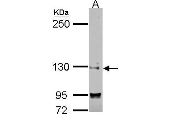 SAP130 抗体  (N-Term)