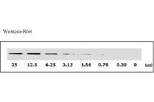 Image no. 3 for Epidermal Growth Factor Receptor (EGFR) ELISA Kit (ABIN625237) (EGFR Kit ELISA)
