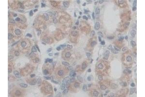 Detection of CF6 in Human Stomach Tissue using Polyclonal Antibody to Coupling Factor 6 (CF6)