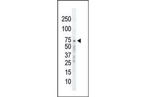 Western blot analysis of anti-GRK2 C-term Pab (ABIN1882061 and ABIN2841168) in Ramos cell lysate.