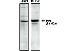 Western blot analysis using PP5 specific antibody on A549 and MCF-7 cell lysates. (PP5.2 anticorps  (C-Term))