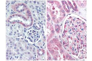 Immunohistochemistry with Anti-nestin antibody Tissue: mouse kidney (Left) and human kidney (Right).