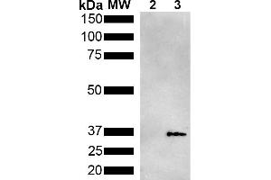Western Blot analysis of Pseudomonas aeruginosa Metallothionein (PmtA) GST tagged showing detection of 36 kDa Metallothionein protein using Mouse Anti-Metallothionein Monoclonal Antibody, Clone 2B5 (ABIN5650705). (Metallothionein anticorps  (FITC))