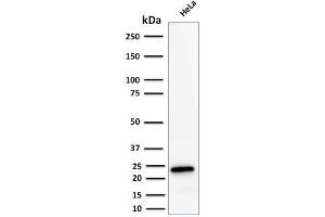 Western Blot Analysis of human HeLa cell lysate using Ferritin LC Rabbit Recombinant Monoclonal Antibody (FTL/2338R).