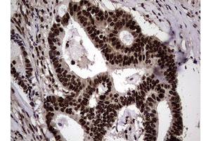 Image no. 3 for anti-Nibrin (NBN) (AA 183-460) antibody (ABIN1491058)