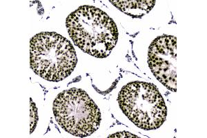 IHC analysis of SAE2/UBA2 using anti-SAE2/UBA2 antibody . (UBA2 anticorps  (AA 449-564))