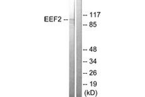 Western blot analysis of extracts from NIH-3T3 cells, treated with serum 10% 30', using eEF2 (Ab-56) Antibody. (EEF2 anticorps  (AA 31-80))