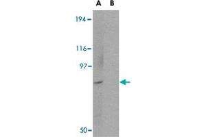 Western blot analysis of BICD1 in Daudi cell lysate with BICD1 polyclonal antibody  at 1 ug/mL in (A) the absence and (B) the presence of blocking peptide.