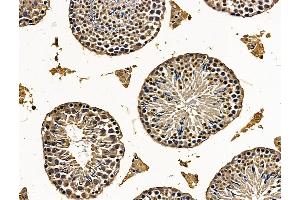 ABIN7096269 and ABIN7100331 at 1/100 staining mouse testis tissue by IHC-P. (SHCBP1L anticorps)