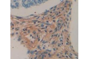 Used in DAB staining on fromalin fixed paraffin- embedded skeletal muscle tissue (Myopalladin anticorps  (AA 945-1320))