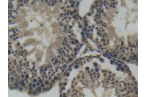 IHC-P analysis of Mouse Testis Tissue, with DAB staining. (SEMA4D/CD100 anticorps  (AA 502-636))