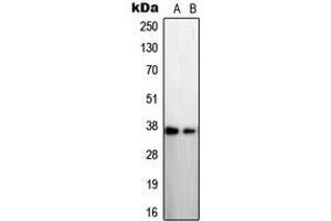 Western blot analysis of STEAP1 expression in LNCaP (A), A431 (B) whole cell lysates. (STEAP1 anticorps  (N-Term))