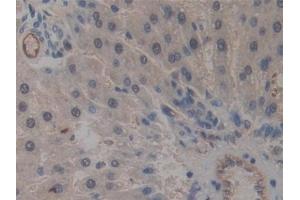Detection of ICAM2 in Rat Liver Tissue using Polyclonal Antibody to Intercellular Adhesion Molecule 2 (ICAM2) (ICAM2 anticorps  (AA 29-247))