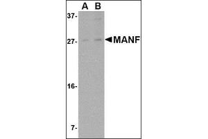 Western blot analysis of MANF in rat brain tissue lysate with this product at (A) 1 and (B) 2 μg/ml. (MANF anticorps  (N-Term))