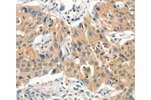 Immunohistochemistry (IHC) image for anti-Solute Carrier Family 11 (Proton-Coupled Divalent Metal Ion Transporters), Member 2 (SLC11A2) antibody (ABIN2432955) (SLC11A2 anticorps)