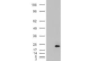 HEK293 overexpressing CRP2 (ABIN5397240) and probed with ABIN238612 (mock transfection in first lane). (CSRP2 anticorps  (Internal Region))