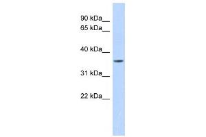 Western Blotting (WB) image for anti-Matrix Metallopeptidase 23B (MMP23B) antibody (ABIN2459052)
