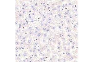 Immunohistochemistry analysis of paraffin-embedded rat hepatitis using,Tal1 (ABIN7075819) at dilution of 1: 1500