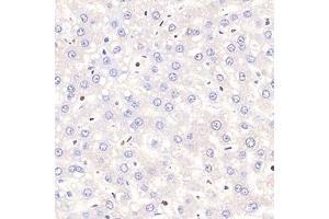 Immunohistochemistry analysis of paraffin-embedded rat hepatitis using,Tal1 (ABIN7075819) at dilution of 1: 1500 (TAL1 anticorps)