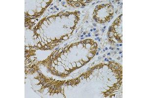 Immunohistochemistry of paraffin-embedded human stomach using SIGMAR1 antibody.