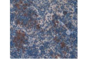 IHC-P analysis of Rat Spleen Tissue, with DAB staining. (KIT anticorps)