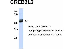 Host:  Rabbit  Target Name:  CREB3L2  Sample Type:  Human Fetal Brain  Antibody Dilution:  1.