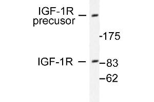 Image no. 1 for anti-Insulin-Like Growth Factor 1 Receptor (IGF1R) antibody (ABIN265476) (IGF1R anticorps)