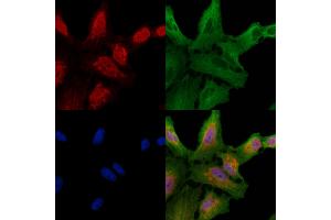 ABIN6257697 and ABIN6274266 staining  cells by IF/ICC. (CLK1 anticorps  (N-Term))