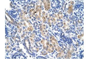 ALDH3A2 antibody was used for immunohistochemistry at a concentration of 4-8 ug/ml to stain Epithelial cells of renal tubule (arrows) in Human Kidney.