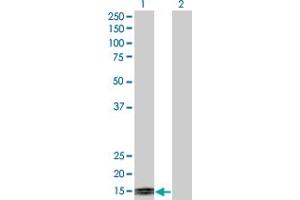 Western Blot analysis of TFF1 expression in transfected 293T cell line by TFF1 monoclonal antibody (M04), clone M2. (TFF1 anticorps  (AA 1-84))