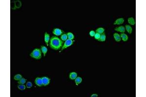 Immunofluorescent analysis of PC-3 cells using ABIN7142715 at dilution of 1:100 and Alexa Fluor 488-congugated AffiniPure Goat Anti-Rabbit IgG(H+L)
