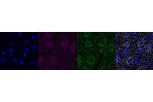 Immunohistochemistry (IHC) image for anti-Ubiquitin Carboxyl-terminal Esterase L1 (Ubiquitin Thiolesterase) (UCHL1) antibody (ABIN7456137) (UCHL1 anticorps)