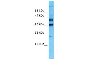 Western Blotting (WB) image for anti-Pleckstrin Homology Domain Containing, Family G (With RhoGef Domain) Member 4B (PLEKHG4B) (C-Term) antibody (ABIN2791858) (PLEKHG4B anticorps  (C-Term))