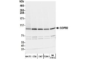 Western Blotting (WB) image for anti-Coatomer Protein Complex, Subunit beta 2 (COPB2) (AA 856-906) antibody (ABIN7453569)