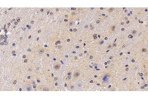 Detection of SEMA5B in Mouse Cerebellum Tissue using Polyclonal Antibody to Semaphorin 5B (SEMA5B)
