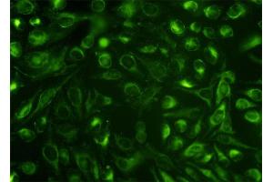 Immunofluorescence of monoclonal antibody to NUCB1 on HeLa cell.