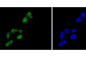 HeLa cells were fixed in paraformaldehyde, permeabilized with 0.