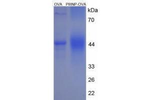 Image no. 3 for Procollagen III N-Terminal Propeptide (PIIINP) (N-Term) peptide (Ovalbumin) (ABIN5666356) (Procollagen III N-Terminal Propeptide (PIIINP) (N-Term) peptide (Ovalbumin))