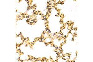 Immunohistochemistry (IHC) image for anti-Importin 5 (IPO5) (AA 20-300) antibody (ABIN3015798)