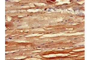 Immunohistochemistry of paraffin-embedded human skeletal muscle tissue using ABIN7145708 at dilution of 1:100 (BMPR1B anticorps  (AA 14-126))