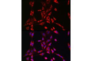 Immunofluorescence analysis of NIH/3T3 cells using PIK3R4/VPS15 Rabbit pAb (ABIN7269323) at dilution of 1:50 (40x lens).