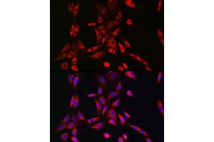 Immunofluorescence analysis of NIH/3T3 cells using PIK3R4/VPS15 Rabbit pAb (ABIN7269323) at dilution of 1:50 (40x lens). (PIK3R4 anticorps  (AA 1-330))