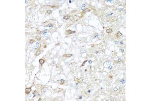 Immunohistochemistry of paraffin-embedded rat brain using R antibody (ABIN3021523, ABIN3021524, ABIN3021525 and ABIN6215193) at dilution of 1:100 (40x lens).