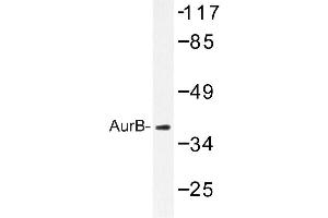 Image no. 1 for anti-Aurora Kinase B (AURKB) antibody (ABIN272096) (Aurora Kinase B anticorps)